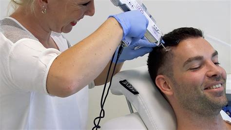 Haartransplantatie Kosten Vergelijken: Waar Moet Je Op Letten?